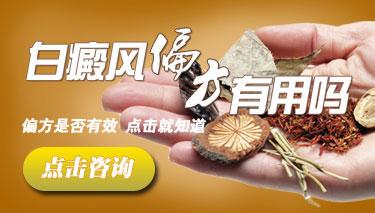 温州中研白癜风专科