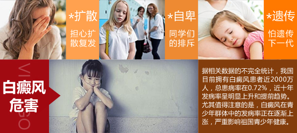 温州中研白癜风专科