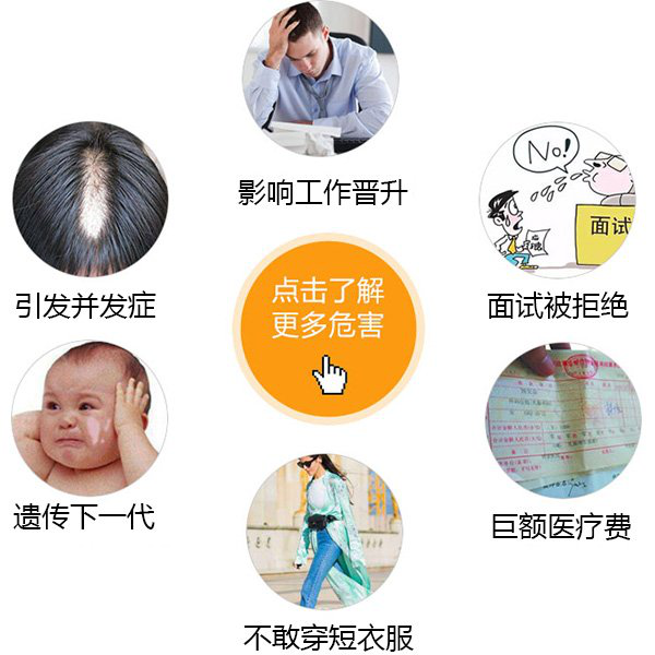 温州中研白癜风专科
